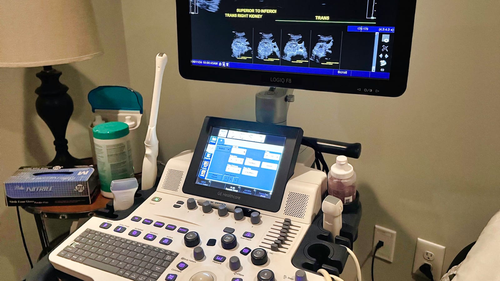 Ultrasound console with attached transducer probes